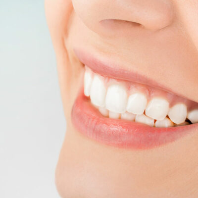 5 Natural Ways to Achieve Whiter Teeth