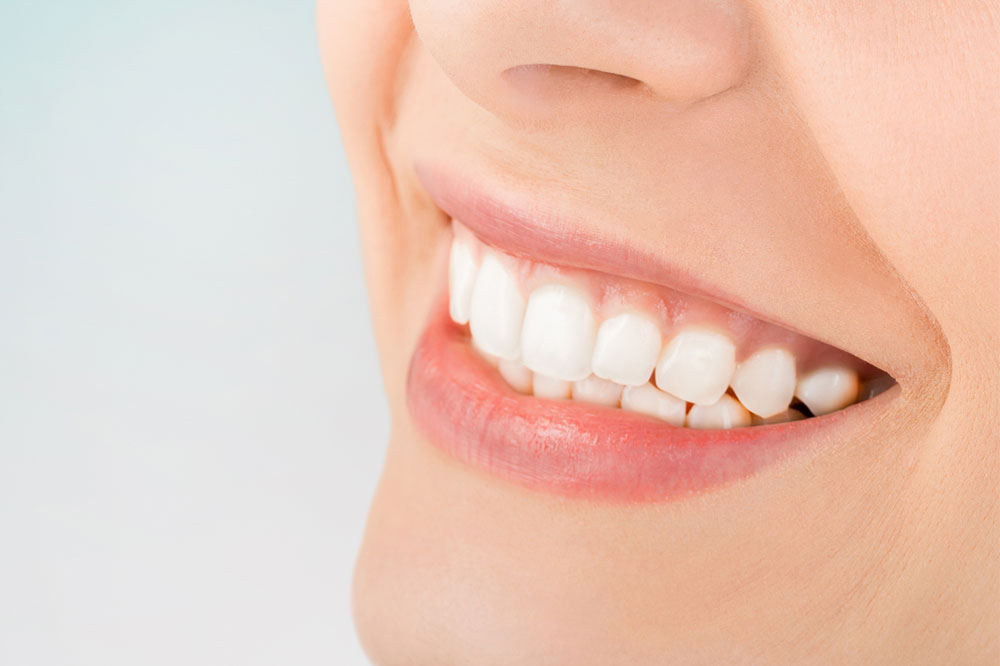 5 Natural Ways to Achieve Whiter Teeth