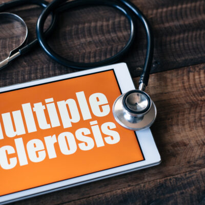 How Can You Treat and Prevent Multiple Sclerosis?