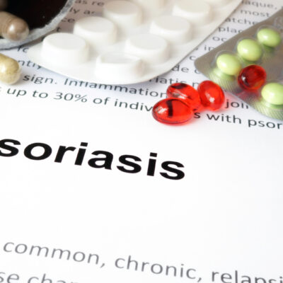 6 Health Conditions Linked to Psoriasis