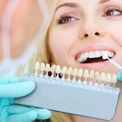 Dental Implant Cost: Instant Ways to Save on Dental Implants