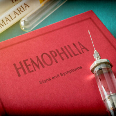 5 Common Symptoms of Hemophilia